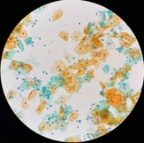 トリコモナス原虫　弱拡大