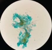 トリコモナス原虫　弱拡大