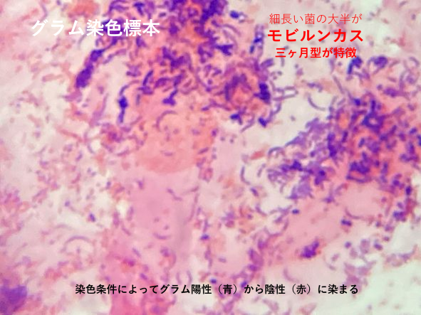 グラム染色した典型的なモビルンカス