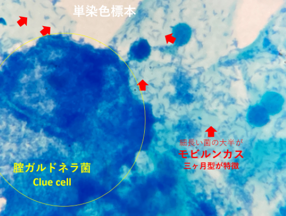 単染色したモビルンカス